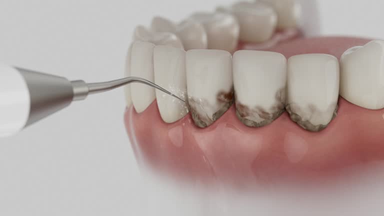 Trusted Invisalign Clear Aligners service in Jena, LA - Dentist Open Now